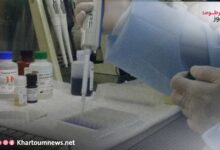 جامعة الخرطوم تعلن عن اكتشاف عقار جديد لعلاج الإيدز