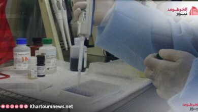 جامعة الخرطوم تعلن عن اكتشاف عقار جديد لعلاج الإيدز
