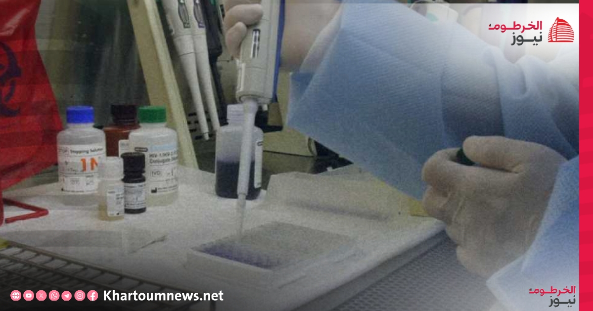 جامعة الخرطوم تعلن عن اكتشاف عقار جديد لعلاج الإيدز